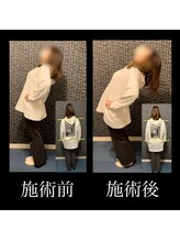 カラダラボ(Karada LAB)/Before After