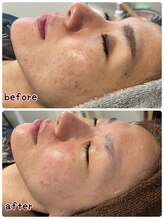 ケースタイル(k.style)/お客様Before after