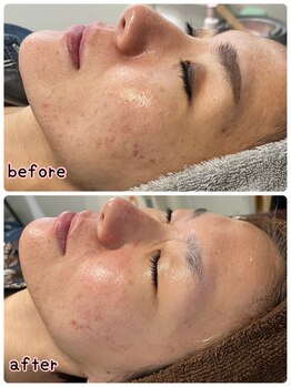 ケースタイル(k.style)/お客様Before after