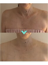 ミルキー(Milky)/お首をケアします