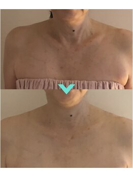 ミルキー(Milky)/お首をケアします