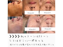 リュミエール デスポワール(Lumiere d'espoir)/韓国トップ白玉ピコジェット