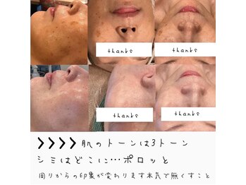 リュミエール デスポワール(Lumiere d'espoir)/韓国トップ白玉ピコジェット