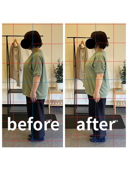 熊本カワル整体 JR上熊本駅院/ストレートネック・巻き肩