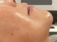 エミュ(e'mu)の写真/【結果重視サロン】大人女性から当店人気！県内希少マシン《HIRFWAVE pro》でシワやたるみを改善！