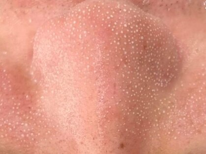 ピーチ(Peach)の写真