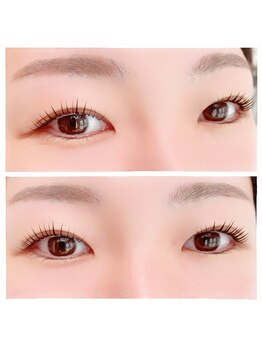 ラピヌ(Lapine)/【アップフォースリフト】