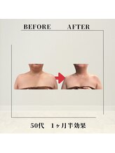フェムビー 千葉駅前店(FEMBE)/痩身）50代の方の変化