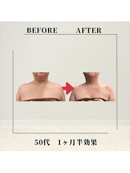フェムビー 千葉駅前店(FEMBE)/痩身）50代の方の変化