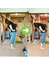 サプライズ整体院/40代ママさんの腰痛初回結果