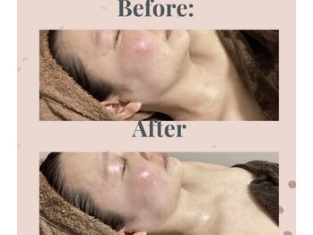 マオ(mao)/☆1回Before→after☆