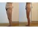 メルシー サロン(Merci Salon)の写真/＜新規様向け体験メニュー＞ 【くっきり♪くびれウエスト】セルゼロをご体感下さい◎【八尾】