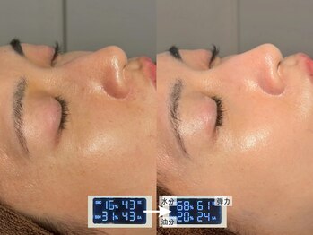 ルーナジェーナ(Luna llena)/池袋 エステ ルーナジェーナ