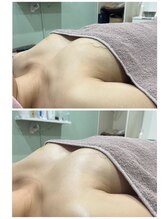 ノンノン(Non Non)/バストアップ１回での結果