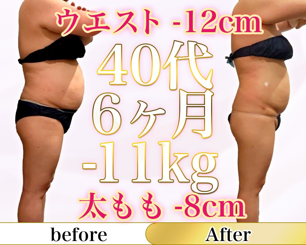ハイパワー■全身対応強力高級超音波美容器 ４５万円★ 小顔・部分やせ・ダイエット ハイフシャワー HIFU｜エイジングケア|浜口皮ふ科形成外科天王寺