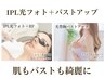 ＼人気セット／　全顔シミケアAMATERASU使用＋バストケア　￥38500→￥16500
