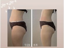 ミヨンビー(miyong.B)/約２週間でこの差！