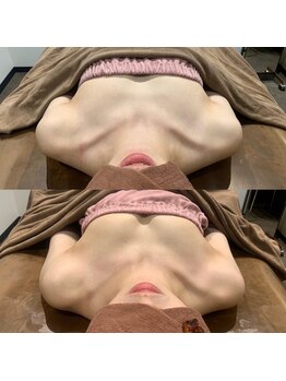 ロココ 豊田店(Rococo)/ビフォーアフター