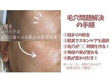 毛穴美の雰囲気（あなたのお肌に向き合います◎）