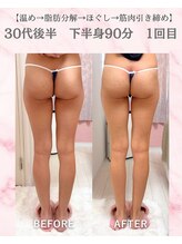 リラ(Lilas)/【痩身】たるみ改善下半身　1回