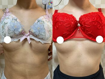 ハレオラ(HaleOla)/お客様の変化☆バストケア