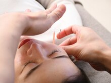 ロスカ(LOSKA)/美容鍼 / 本町鍼灸サロン