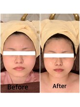 スペチアーレ 夙川/小顔と美肌が手に入る