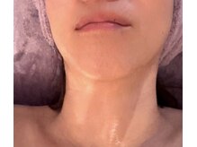 スペシャル・リジュランスチームパック３回目＋home care３週目