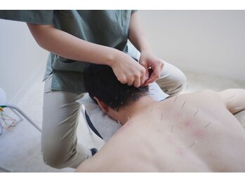 渋谷ビファイン鍼灸治療院/腰痛、不眠、眼精疲労、頭痛