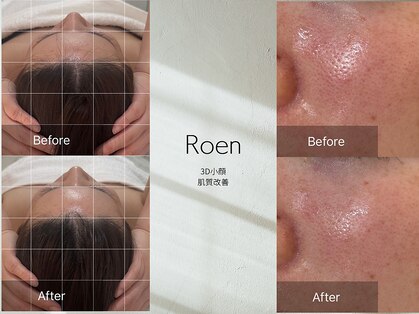 ロエン(Roen)の写真