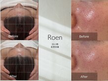 ロエン(Roen)