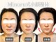 フレキシボディ(FlexiBody)の写真