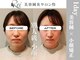 怜(Rei)の写真