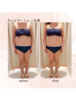 エイム(ame)/キャビテーション効果すごい！