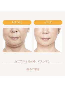 ムーンライズ(moonrise)/