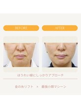 ムーンライズ(moonrise)/