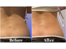 サロンビー 赤坂(SalonB)の雰囲気（最先端マシンの圧倒的効果！今迄何を試しても痩せなかった方へ◎）