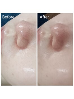 Beauty salon Ren/ラテスパ