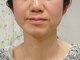 目元 口元のたるみ 眉間シワ改善専門サロンの写真/年と共に濃く長くなるほうれい線の原因は「内臓疲労」!