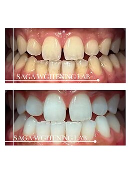 佐賀ホワイトニングラボ/
