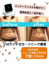 ボディデザインホームクレアフェリーチェ 神戸(Body design home Crea felice)/関西初導入！ソニーク痩身