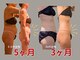 腸と頭の写真