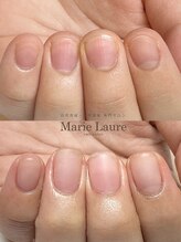 マリーロール 梅田店(Marie Laure)/自爪育成/深爪矯正/ネイルケア