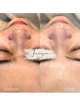 フリージア(Freesia)/水分量も上がります◎