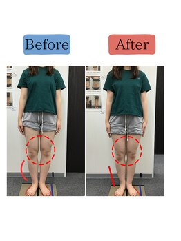 ステイゴールド美容整体院(STAY GOLD)/整体で美脚目指しましょう