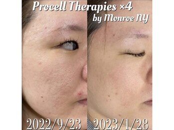 シルク ド ココ(Silk de Coco)/プロセルセラピーズフェイシャル