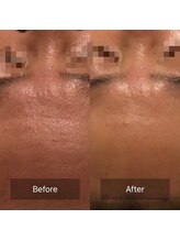 ファヴォリ(favori)/ゾンビマスク