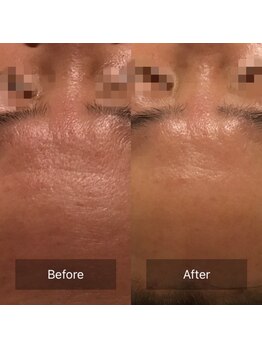 ファヴォリ(favori)/ゾンビマスク