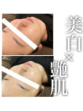 ヴィヴフォー(VIV for)/艶肌へ