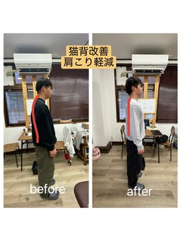 アンティオール 古河店/猫背、巻き肩解消！【古河整体】